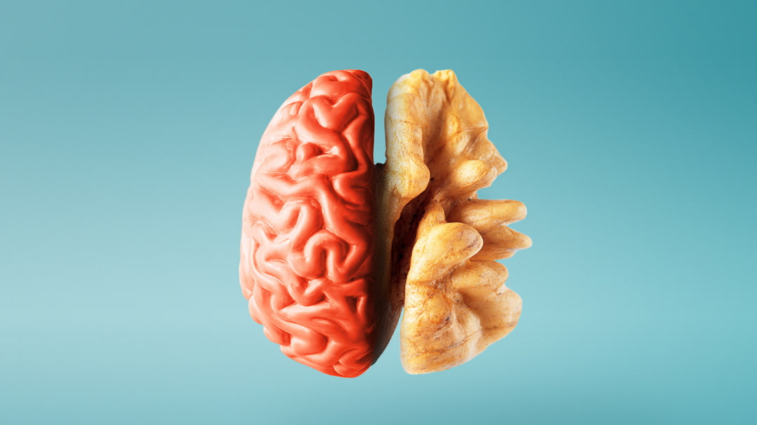 6 Science-Backed Foods For Brain Fog 