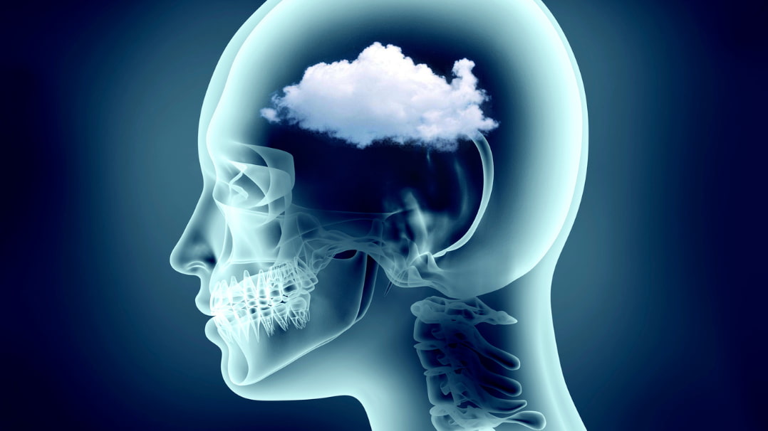 Brain Fog Taking Over Your Life? 5 Reasons Why According to a Neuroscientist